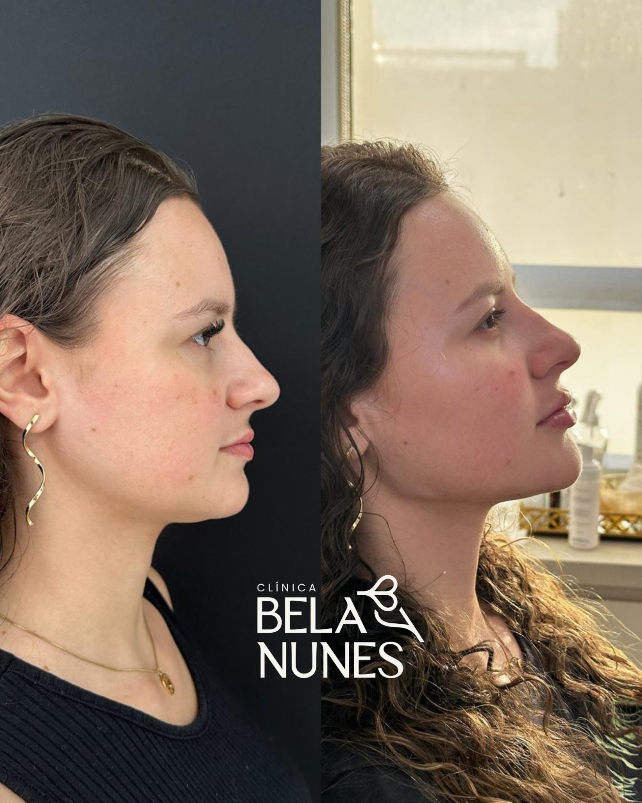 Resultado 1: antes e depois