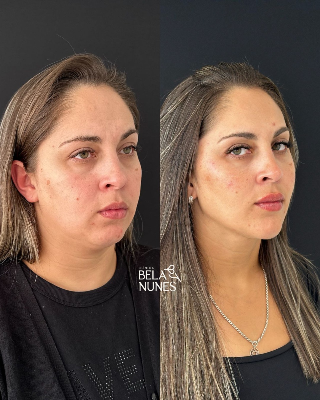Resultado 2: antes e depois