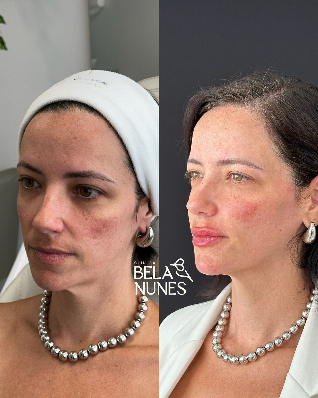 Resultado 3: antes e depois