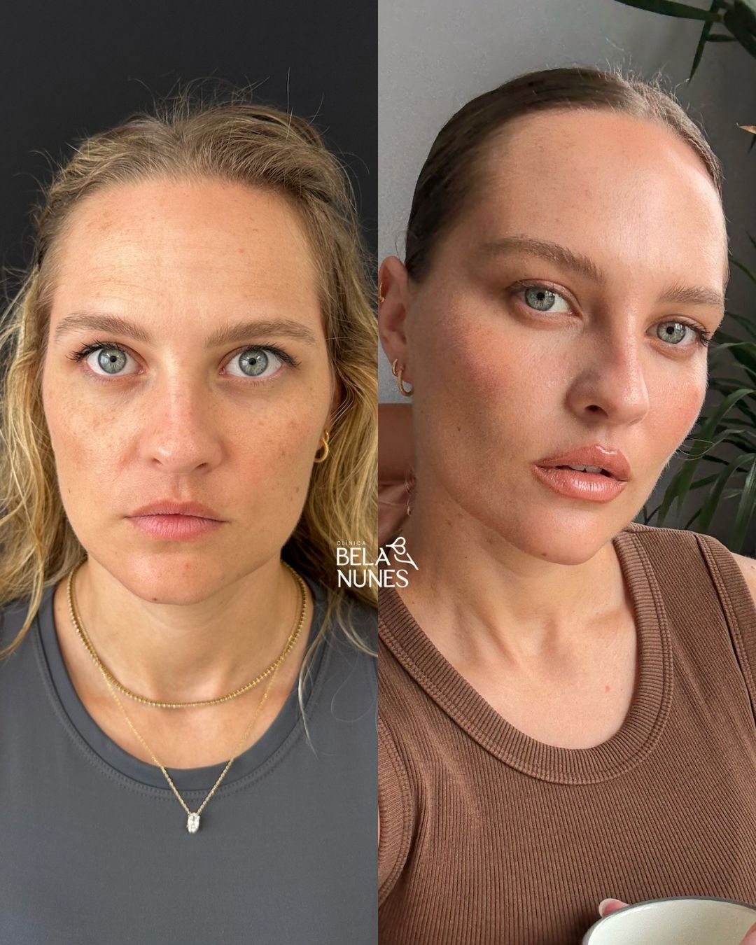 Resultado 5: antes e depois