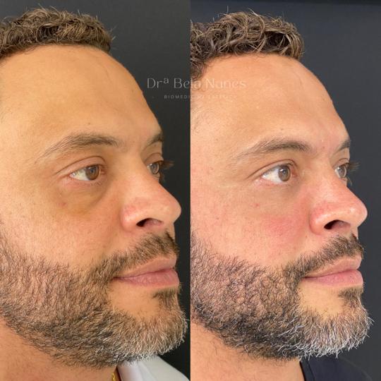 Resultado 7: antes e depois
