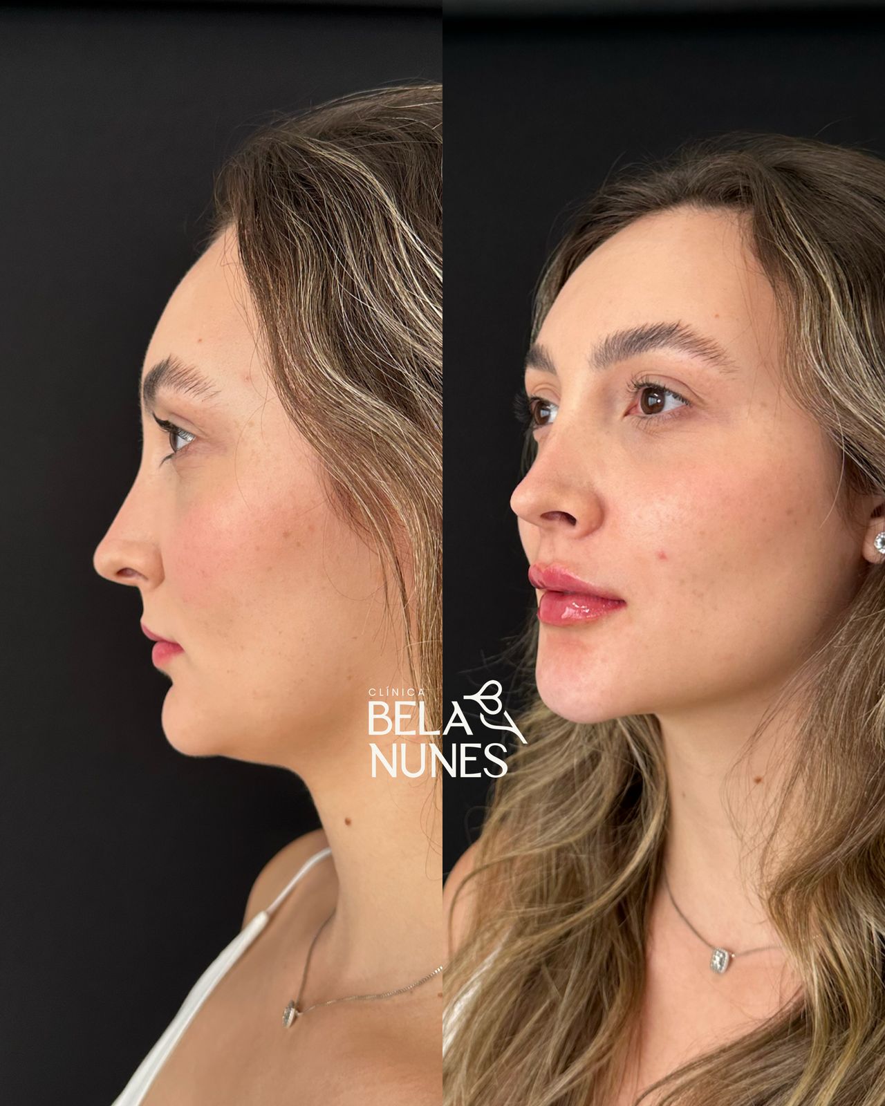 Resultado 10: antes e depois