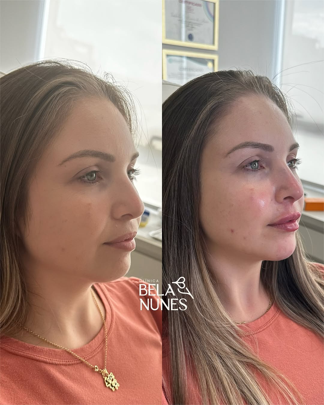 Resultado 12: antes e depois